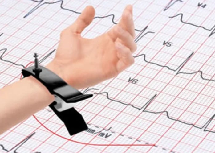 Hand wearing smartwatch positioned over ECG graph showing heart rhythm readings and waveforms